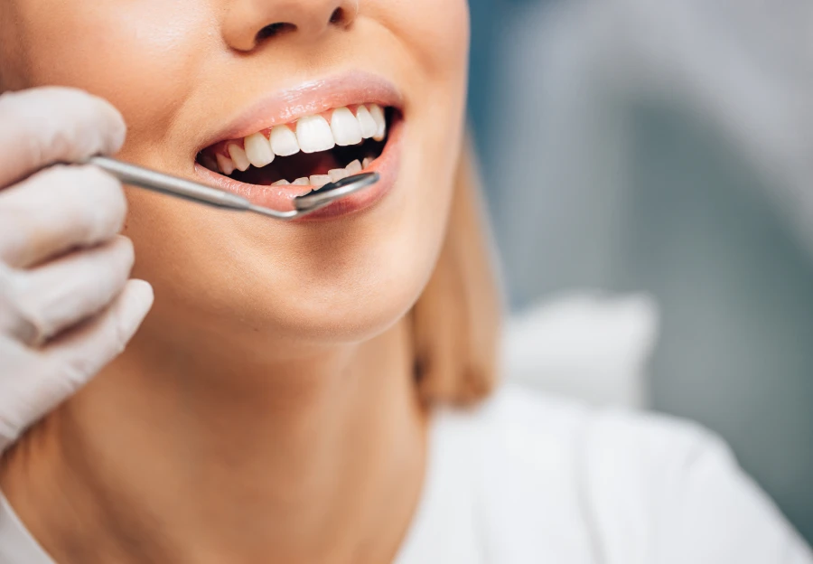 Réhabilitation esthétique globale au cabinet des chirurgiens-dentistes Dr Maxime Biard et Dr Franck Vincent